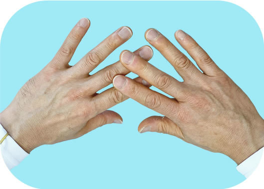 アプライドキネシオロジー(筋肉反射テスト)